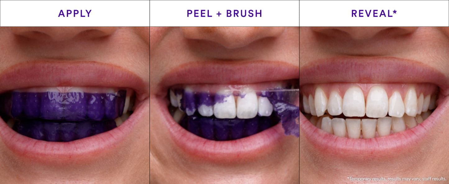 Purple Smile Strips