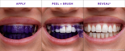Purple Smile Strips